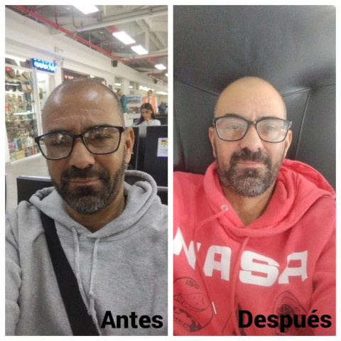 Donación de órganos