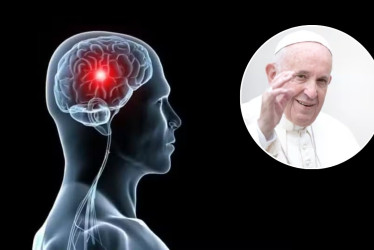 El papa Francisco sufrió un ictus que lo indujo a un coma y a un paro cardiorrespiratorio.