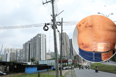 Carlos Fernández, conocido como el Llanerito, labora en Lavautos Chips El Trébol, ubicado en la avenida Kevin Ángel de Manizale