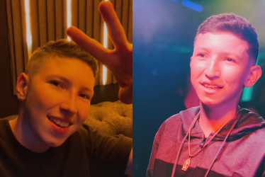 El cambio de look del caldense Cris Valencia desató todo tipo de comentarios en redes sociales. Se operó la nariz y las orejas.