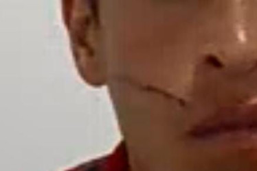 Foto| LA PATRIA  Wílmer, el capturado, tuvo una lesión en la cara.