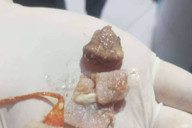 Fotos|Cortesía Adolfo Tovar|LA PATRIA  Dos perras fueron envenenadas en una vivienda en Chinchiná. Los dueños no se encontraban para socorrerlas. Se investiga quién les pudo arrojar el cebo con un químico.