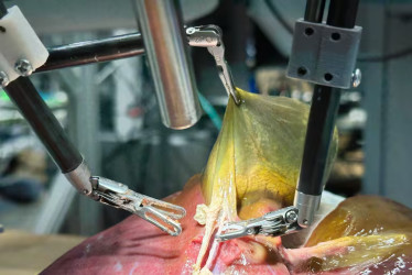 El robot SRT-H aprendió a realizar la operación de vesícula biliar viendo vídeos de cirujanos de la Johns Hopkins en cadáveres de cerdos.