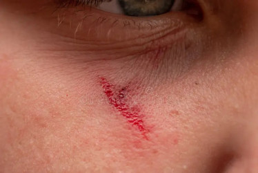 Una mujer atacó a la otra.