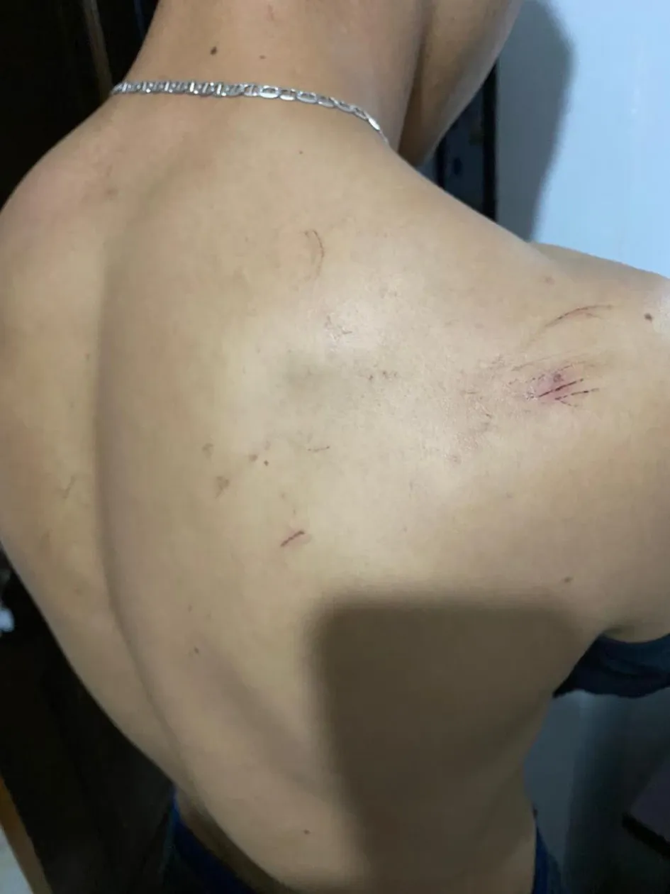 Lesiones que dice haber sufrido el denunciante tras el enfrentamiento con el otro hombre.