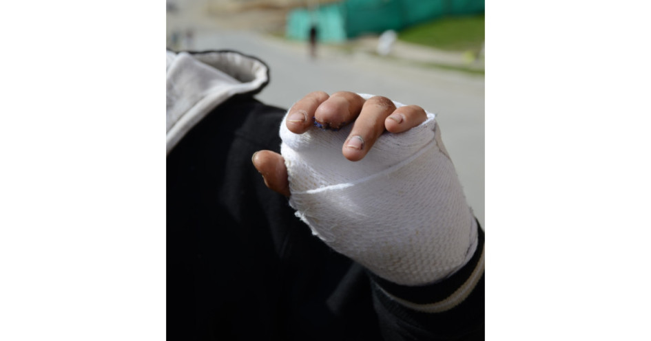 La ciudad duplica la cifra de quemados registrada en el período de vigilancia 2022-2023.