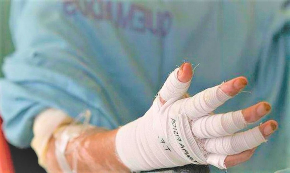 Tres personas, de 31, 38 y 36 años, sufrieron quemaduras por utilizar pólvora en Manizales y San José (Caldas).