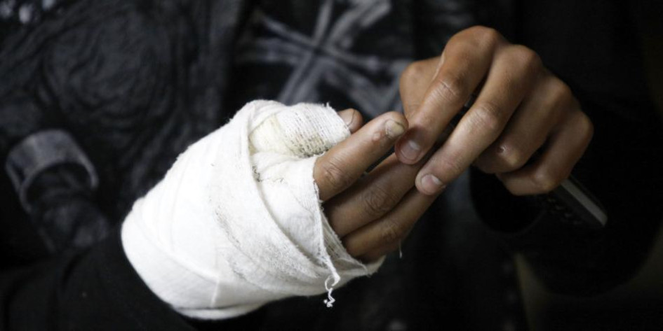 Foto | Archivo | LA PATRIA Según la Dirección Territorial de Salud de Caldas (DTSC), esto son los reportes de los lesionados con pólvora en las últimas tres vigencias: 2021-2022: 33 casos, 2022-2023: 28 casos y 2023-2024: 47 casos.