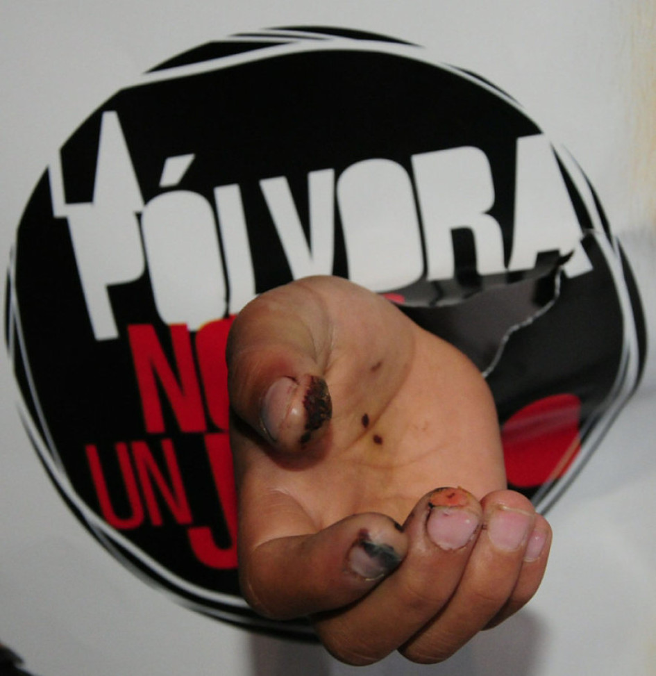 Tanto la Alcaldía de Manizales como la Gobernación de Caldas hicieron lanzamientos de campañas contra el uso de la pólvora en Navidad.