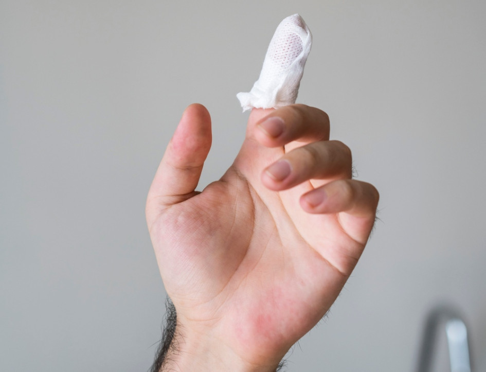 Con corte a 9 de diciembre en Risaralda se contabilizan 6 quemados por pólvora, todos ocurridos en el área metropolitana: