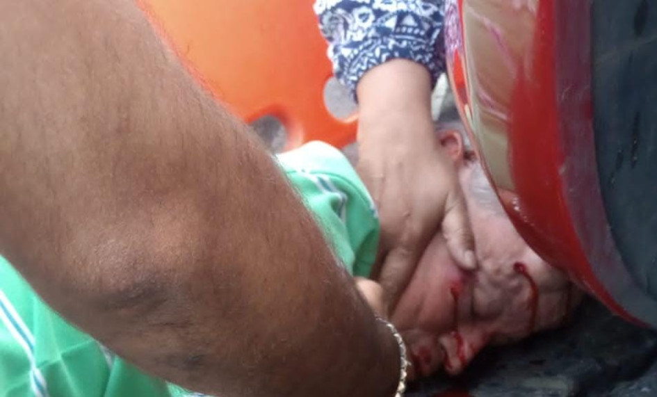 Al lesionado lo identificaron como Darío de Jesús Rodríguez García.