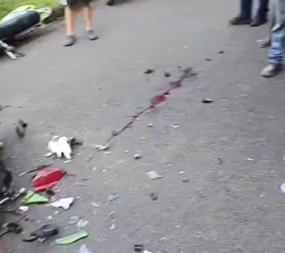 El conductor de una motocicleta, un adulto mayor, murió de manera instantánea, mientras el otro involucrado resultó con lesiones de consideración.