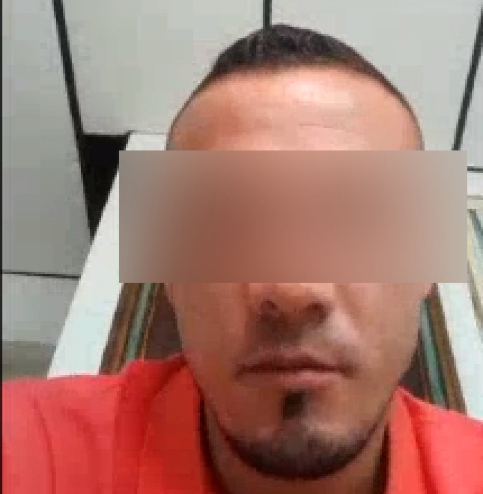 Galvis habría atacado a botellazos a un policía en Solferino.