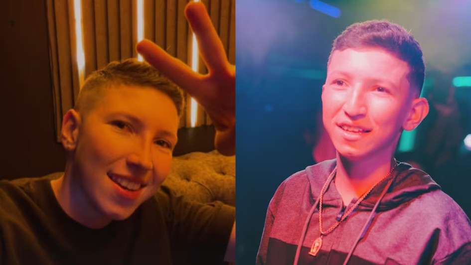 El cambio de look del caldense Cris Valencia desató todo tipo de comentarios en redes sociales. Se operó la nariz y las orejas.