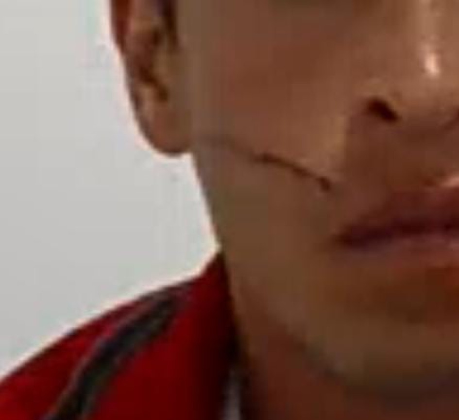 Foto| LA PATRIA  Wílmer, el capturado, tuvo una lesión en la cara.