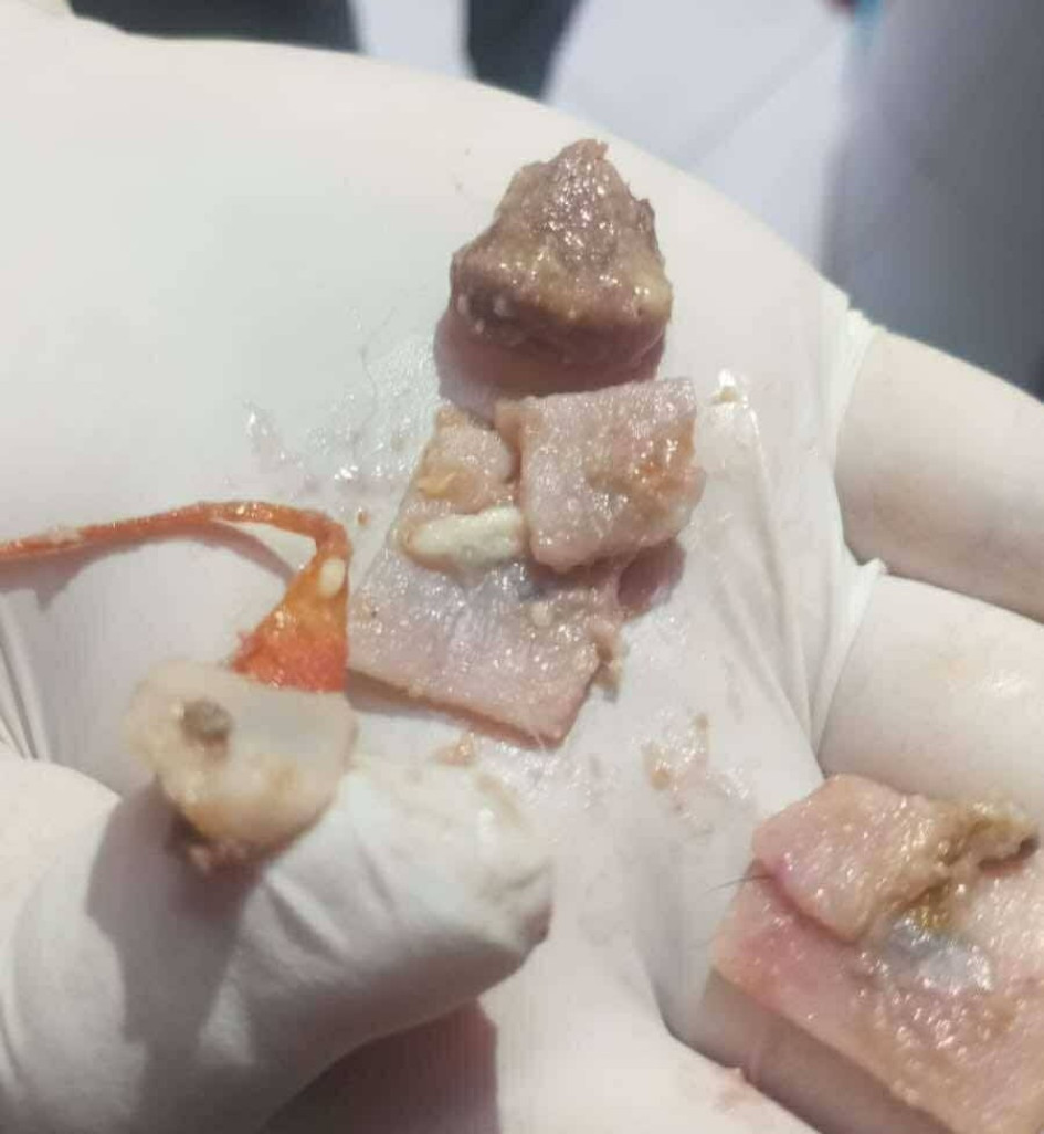 Fotos|Cortesía Adolfo Tovar|LA PATRIA  Dos perras fueron envenenadas en una vivienda en Chinchiná. Los dueños no se encontraban para socorrerlas. Se investiga quién les pudo arrojar el cebo con un químico.