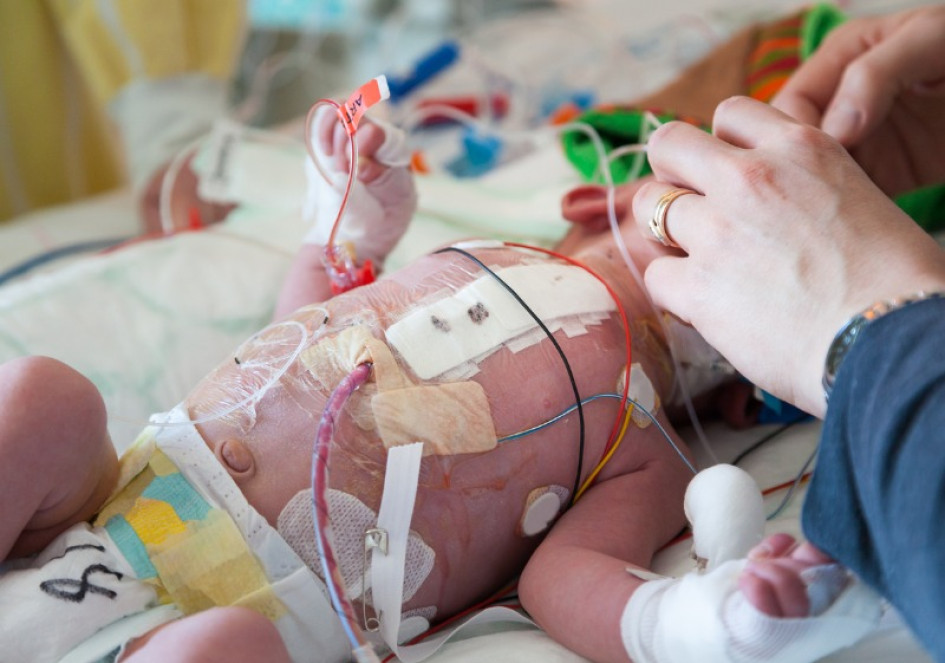 "Alerta en Quindío: 28 muertes perinatales y una materna sacuden al sistema sanitario"