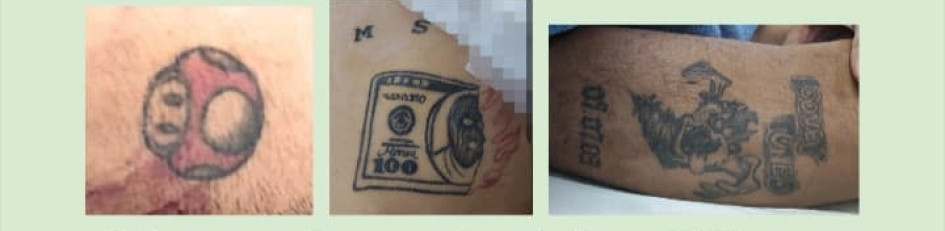 Los tatuajes del fallecido.