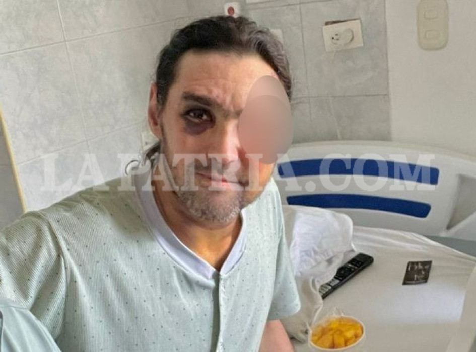 A Gustavo Gil lo abordaron dos sujetos que se movilizaban en moto y lo atacaron con un tubo de metal.