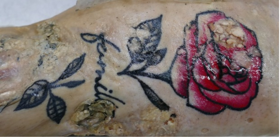 Uno de los tatuajes de la víctima.