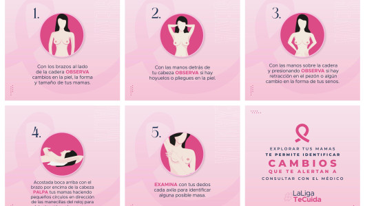 Es tiempo de actuar para la detección temprana del cáncer de mama