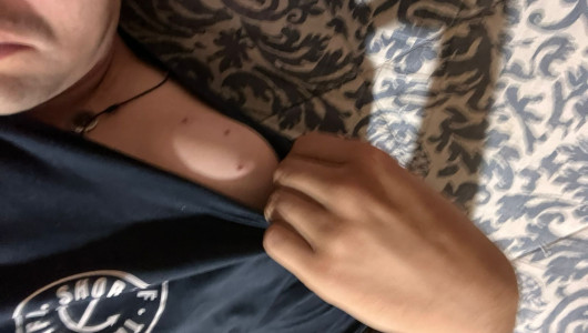 Temen por su seguridad y la de perros rescatados en Villamaría