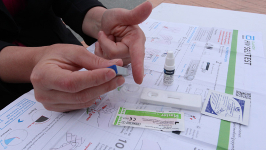 Con el VIH, cerca de la prevención y lejos de prejuicios