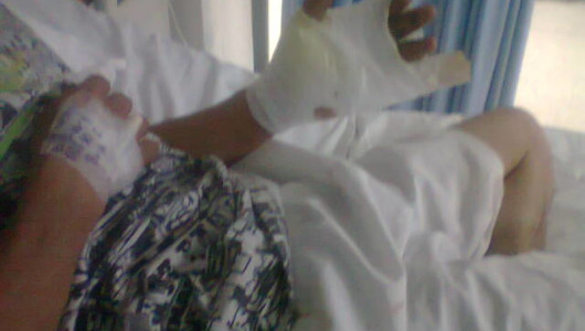 Acérquese a la prevención contra la pólvora, no a las quemaduras