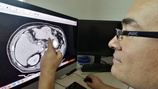 El diagnóstico temprano, crucial para superar el cáncer de mama