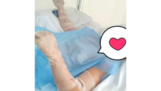 Sufrió quemaduras de tercer grado mientras trabajaba en finca y su familia busca ayuda