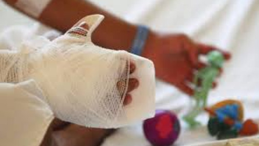 Caldas suma 4 lesionados por pólvora este 11 de diciembre, la cuenta departamental llega a 19: denuncie su uso