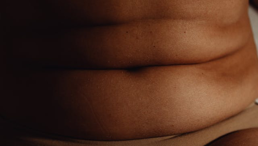 Obesidad y riesgo de infecciones: hay una alerta sobre el impacto del peso en la salud global