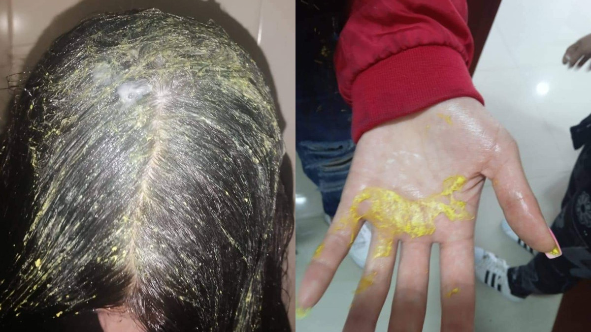 A estudiante le vaciaron un recipiente con bóxer en la cabeza