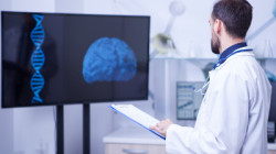 Échele cabeza y evite un Accidente Cerebrovascular