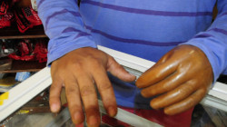 En la Dirección Territorial de Salud de Caldas siguen en guardia contra la pólvora