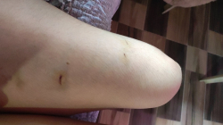 Señalan a policía de agredir a su expareja en La Dorada