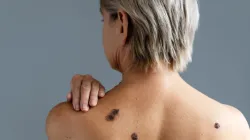 El cáncer es su problema y usted tiene la solución