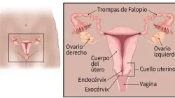 ¡El cáncer de cuello uterino se detecta a tiempo!