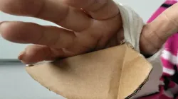 Gloria fue por yeso a Asmet Salud y la devolvieron con cartones