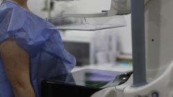 La detección temprana, clave para un tratamiento oportuno del cáncer de mama