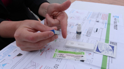 Con el VIH, cerca de la prevención y lejos de prejuicios