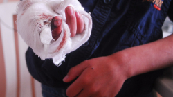 Caldas va perdiendo el año con la pólvora para el período de vigilancia 2023-2024