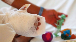 Un niño y un adulto resultaron quemados por pólvora en Salamina 