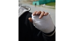 2023 - 2024, con 19 quemados más por pólvora en Caldas con respecto al período anterior