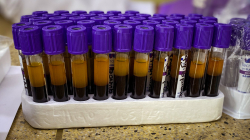 45 caldenses le dicen sí al genoma humano: proyecto de Bios