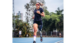 Tras cuatro años de lucha pensionan a futbolista colombiana que perdió una pierna