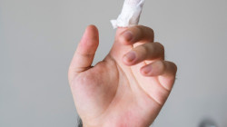 Una mujer es la sexta lesionada con pólvora en Caldas