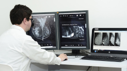 Revelan por qué algunos cánceres de seno son más agresivos que otros