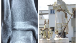 Este hospital de Manizales hará las radiografías de los usuarios de Assbasalud