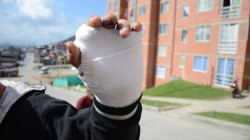 Aumentan lesionados por pólvora en Colombia: más de 1,400 afectados, involucrados menores de edad 